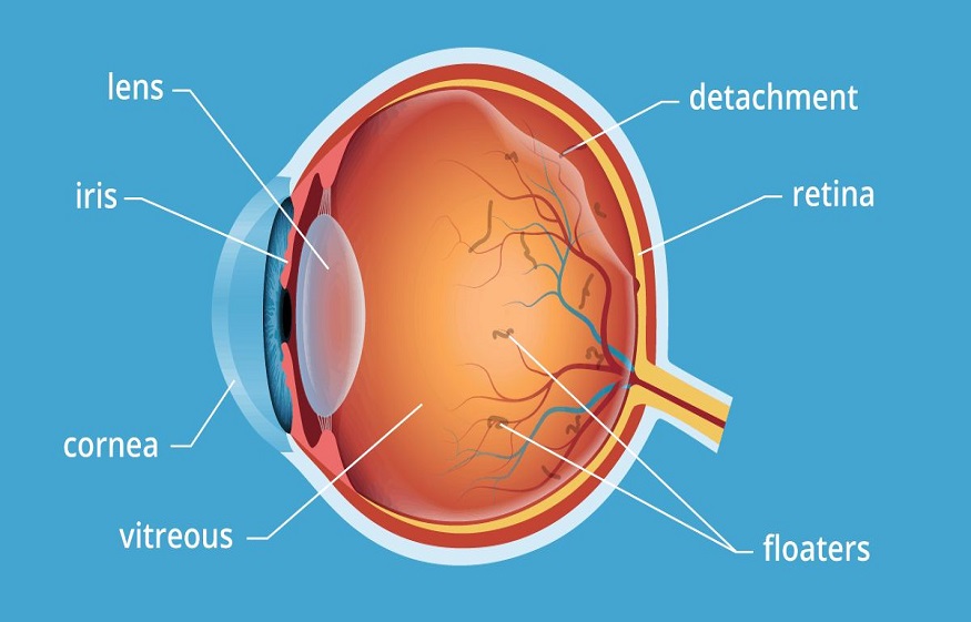 Learn About Floaters In The Human Eye’s