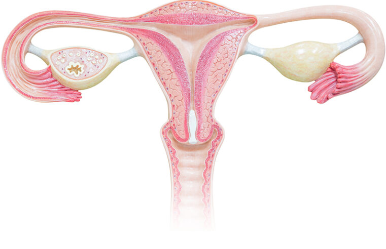 Treatment And Types Of Surgeries To Treat Gynecologic Cancer